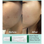 Dark Spot Correcting Glow Serum AXIS-Y