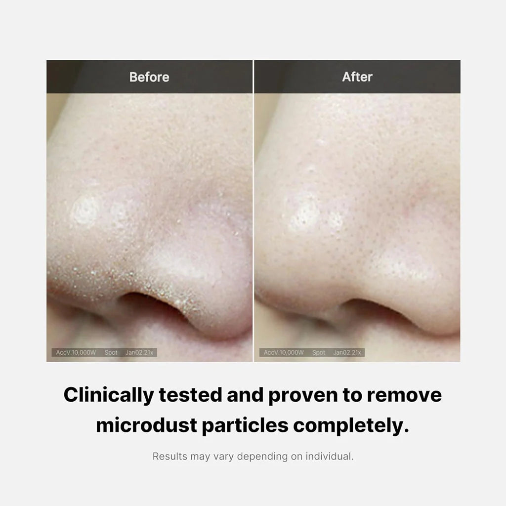 MEDICUBE Zero Foam Cleanser Limpiador Control Poros y Piel Grasa
